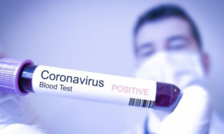 Kako izgleda i šta se događa tokom testiranja na koronavirus COVID-19