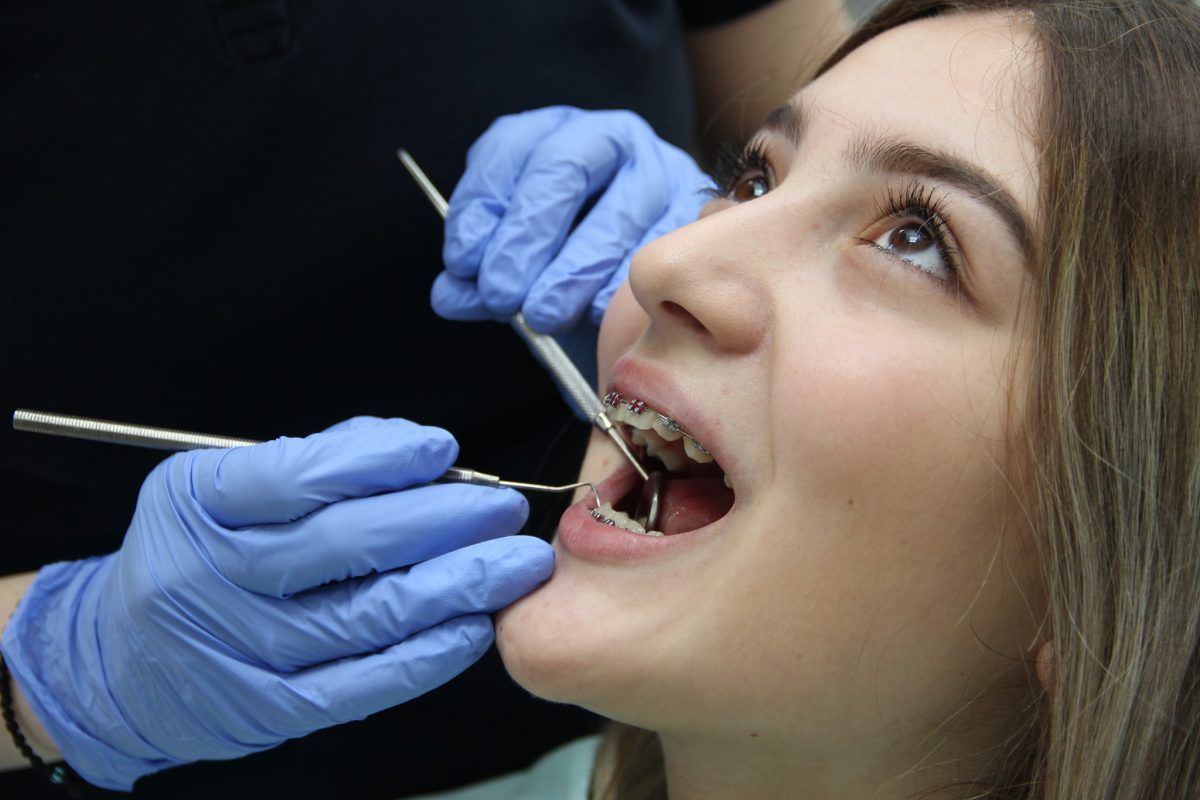 Prednosti ortodontske terapije kod nas!