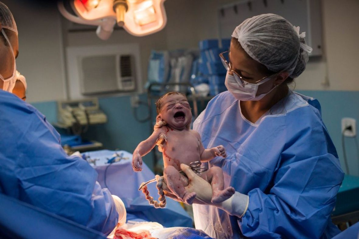 Hit na internetu: Pogledajte izraz lica ove bebe kada je došla na svijet