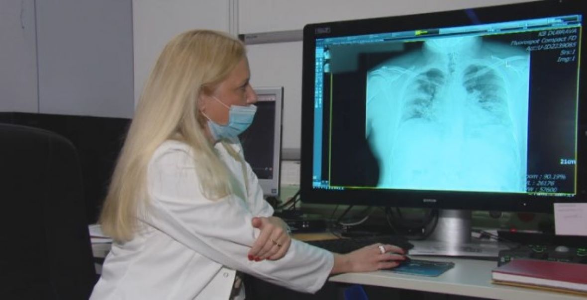Ovo je rendgenska snimka pluća nevakcinisanog muškarca