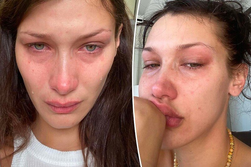 Bella Hadid: Svi izgledamo lijepo na Instagramu, ali vodimo iste bitke u stvarnosti