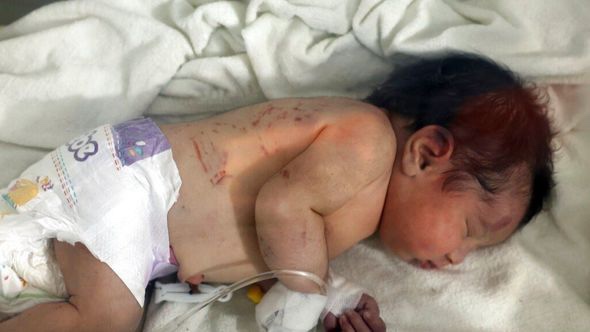 Hiljade ljudi želi usvojiti bebu izvučenu ispod ruševina u Siriji
